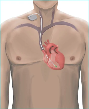 cardiology